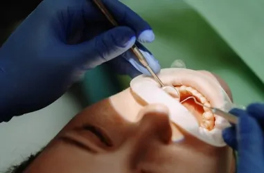 Заміна старої пломби: показання та причини | DENTART Заміна старої пломби: показання та причини