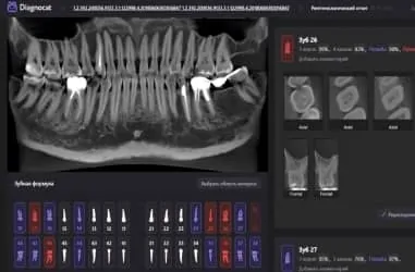 Diagnocat. Розшифровка КТ-знімків за допомогою штучного інтелекту