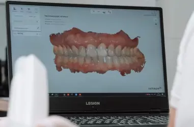 Цирконієві коронки: ціна, переваги | DENTART Цирконієві коронки: ціна, переваги
