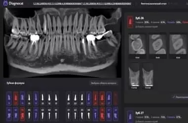 Diagnocat. Розшифровка КТ-знімків за допомогою штучного інтелекту