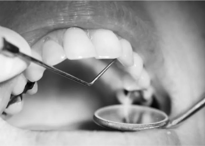 Лікування карієсу | DENTART Лікування карієсу
