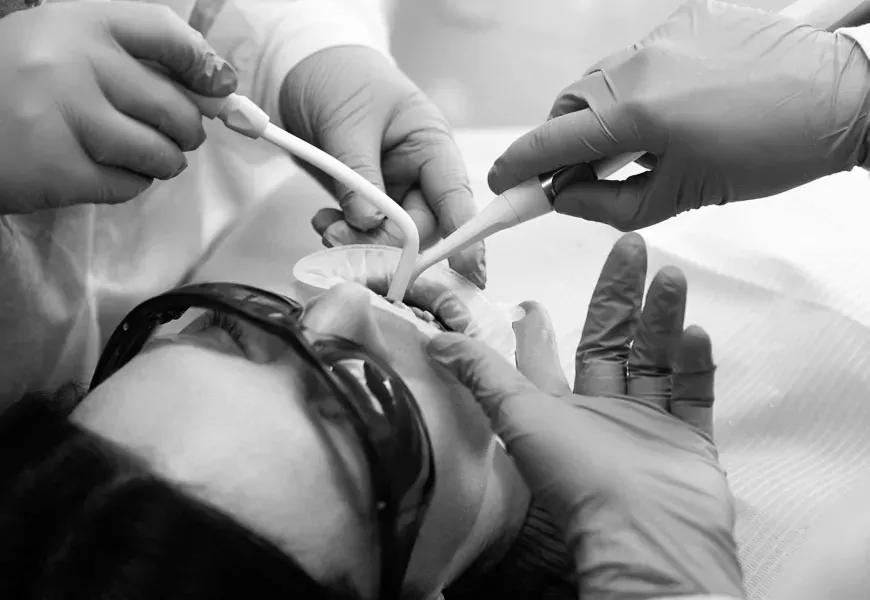 Tooth polishing | DENTART Tooth polishing