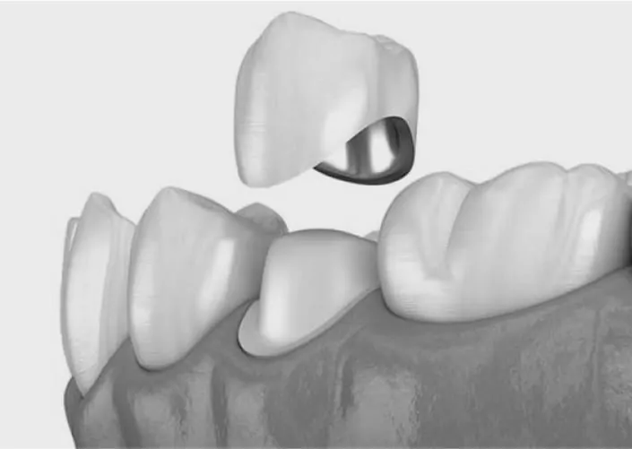 Prosthodontics