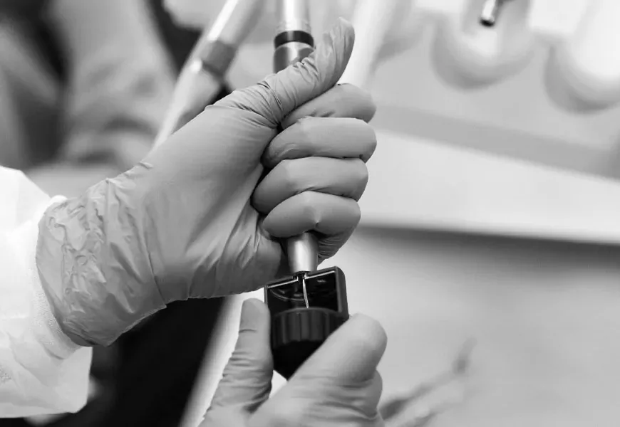 Ultrasonic removal of deposits | DENTART Ultrasonic removal of deposits
