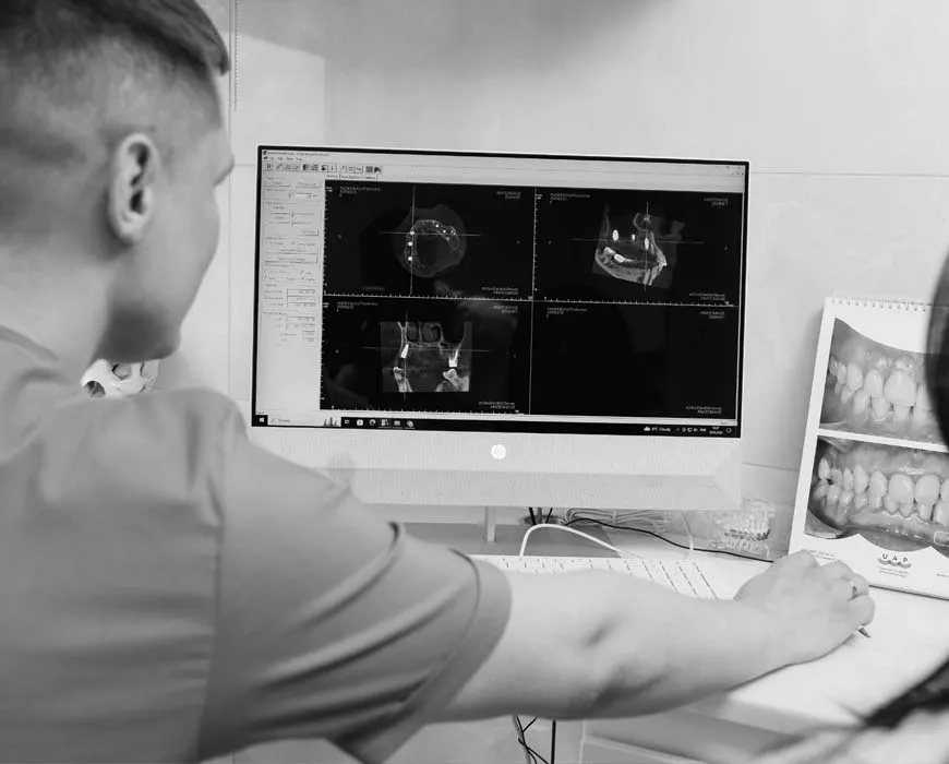 All-on-6 implantation фото