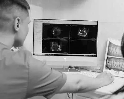 All-on-6 implantation фото