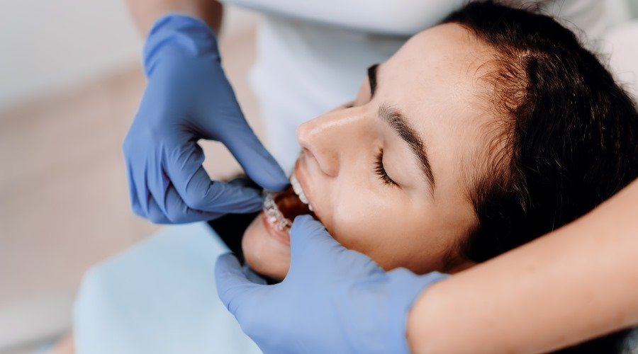 Как выравнивают зубы элайнеры. Стоматология DentArt в Киеве.